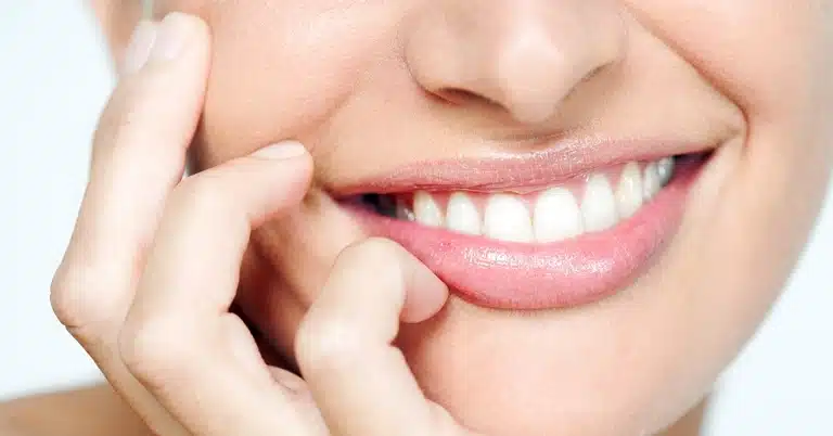 Tips Gigi Putih Bersih Secara Alami Dengan Cepat dan Ampuh